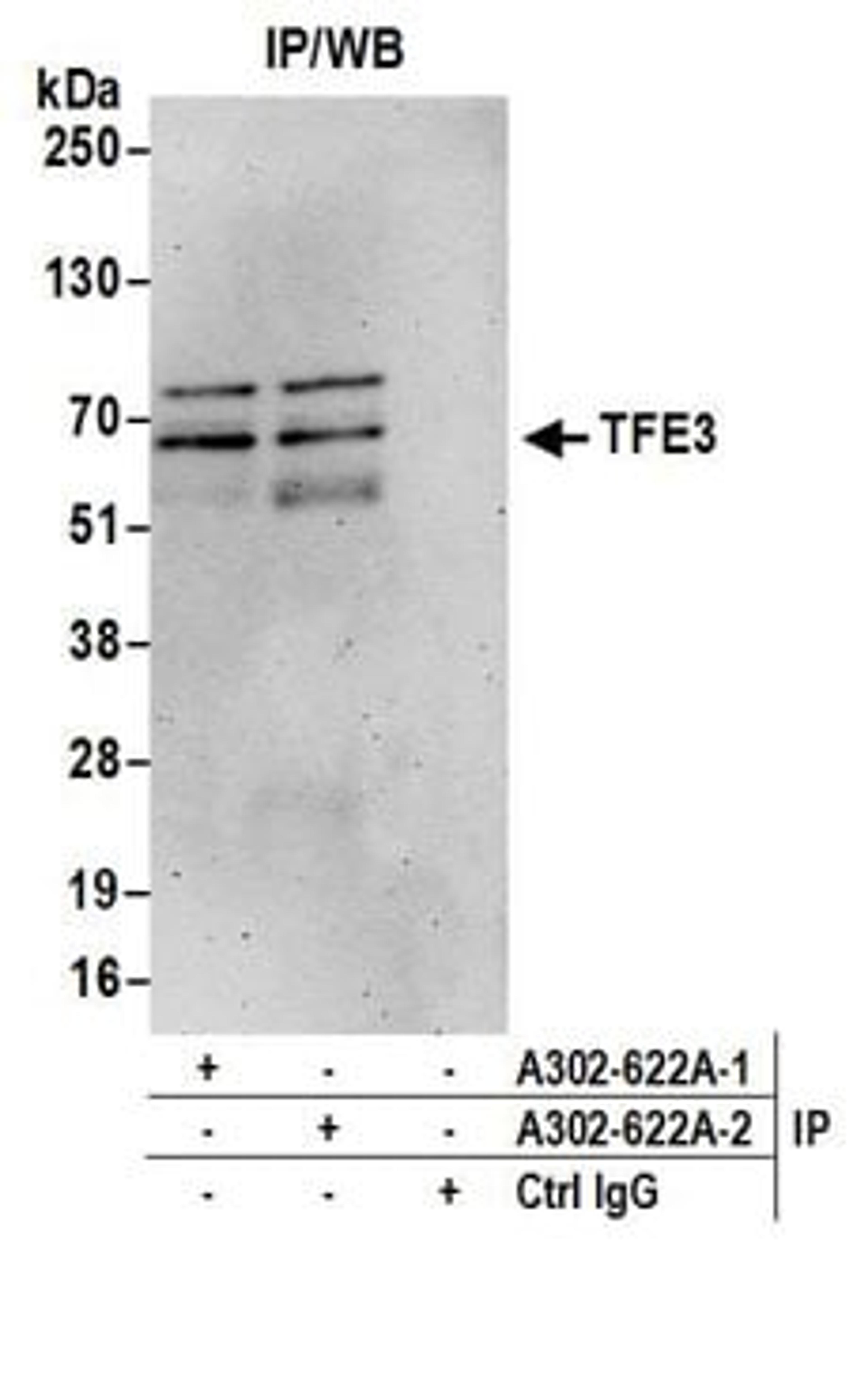 Detection of human TFE3 by western blot of immunoprecipitates.