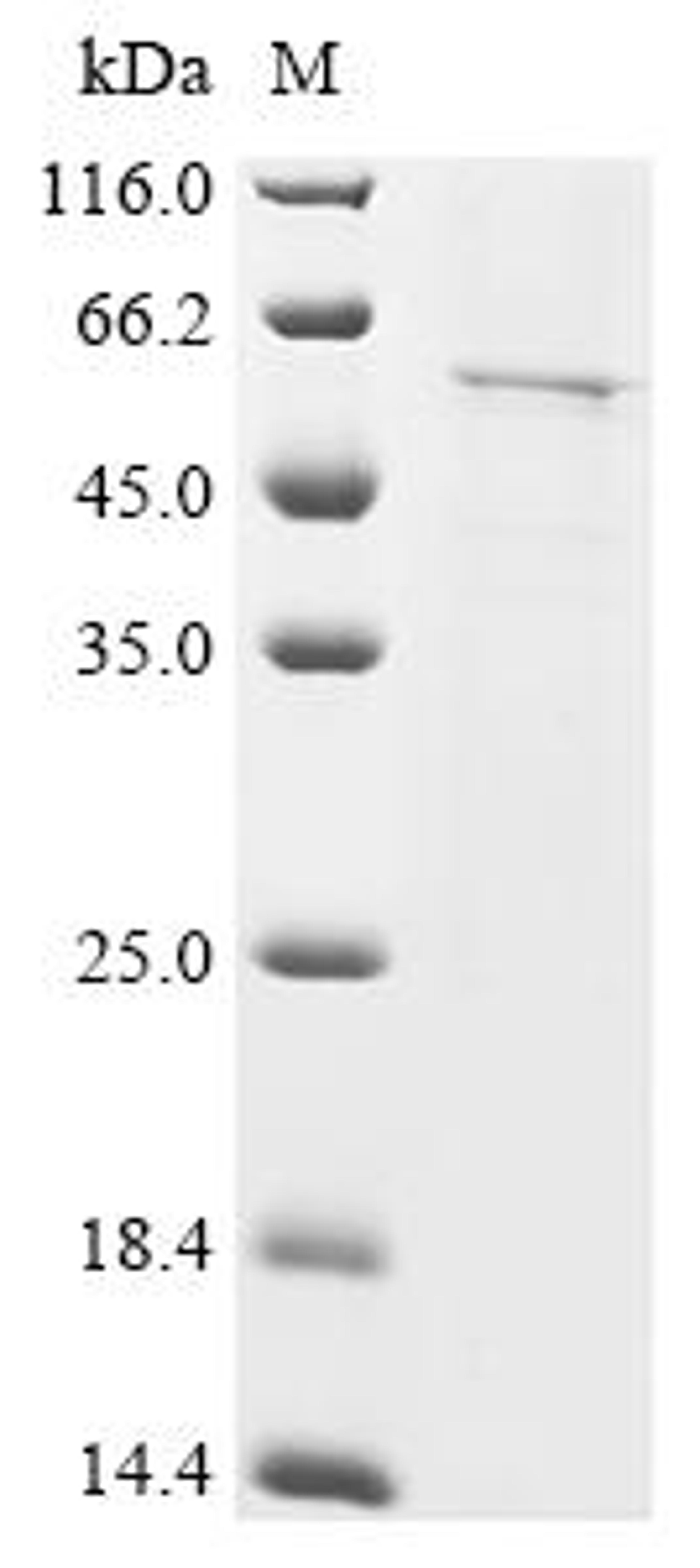 (Tris-Glycine gel) Discontinuous SDS-PAGE (reduced) with 5% enrichment gel and 15% separation gel.