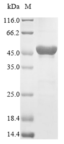(Tris-Glycine gel) Discontinuous SDS-PAGE (reduced) with 5% enrichment gel and 15% separation gel.