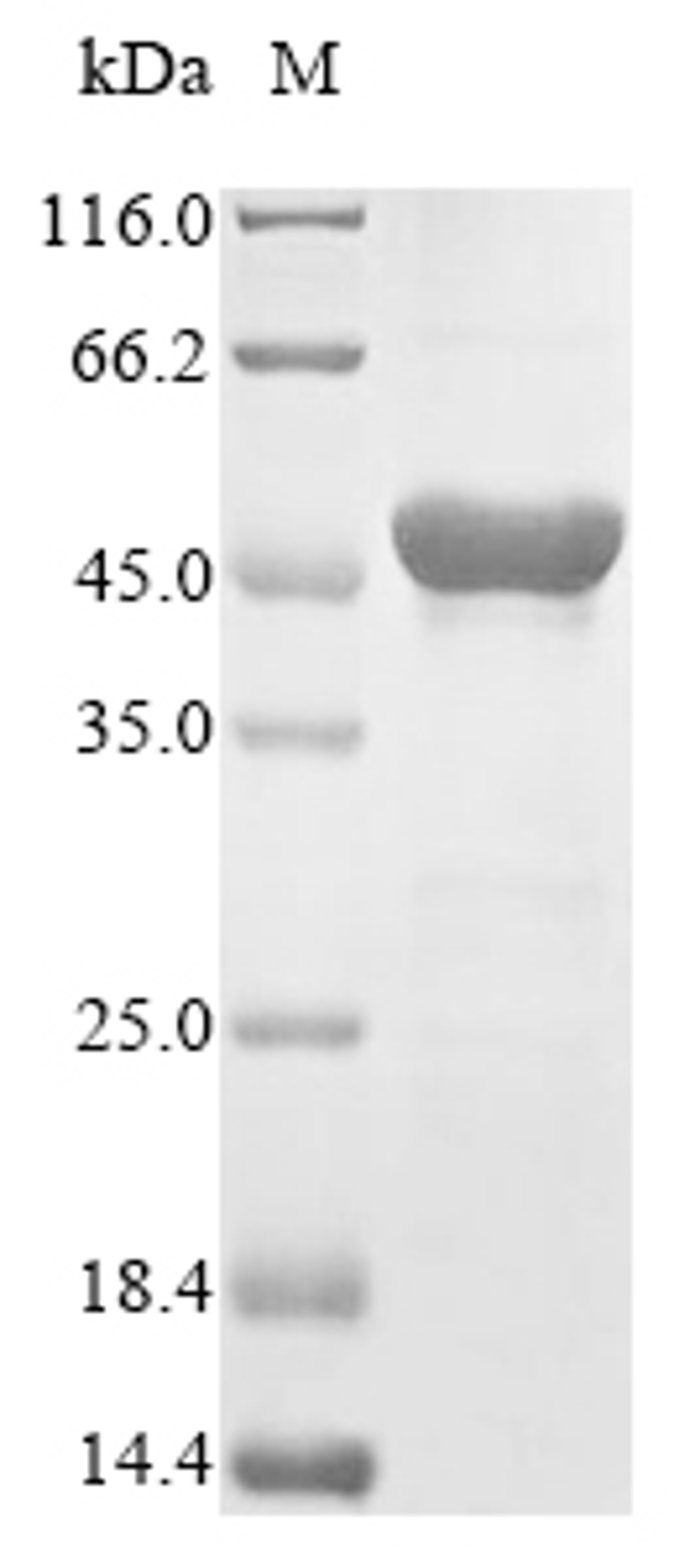 (Tris-Glycine gel) Discontinuous SDS-PAGE (reduced) with 5% enrichment gel and 15% separation gel.