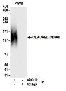 Detection of human CEACAM8/CD66b by western blot of immunoprecipitates.