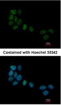 Immunocytochemistry/Immunofluorescence: Serum Response Factor SRF Antibody [NBP1-33063] - Paraformaldehyde-fixed A431, using antibody at 1:500 dilution.