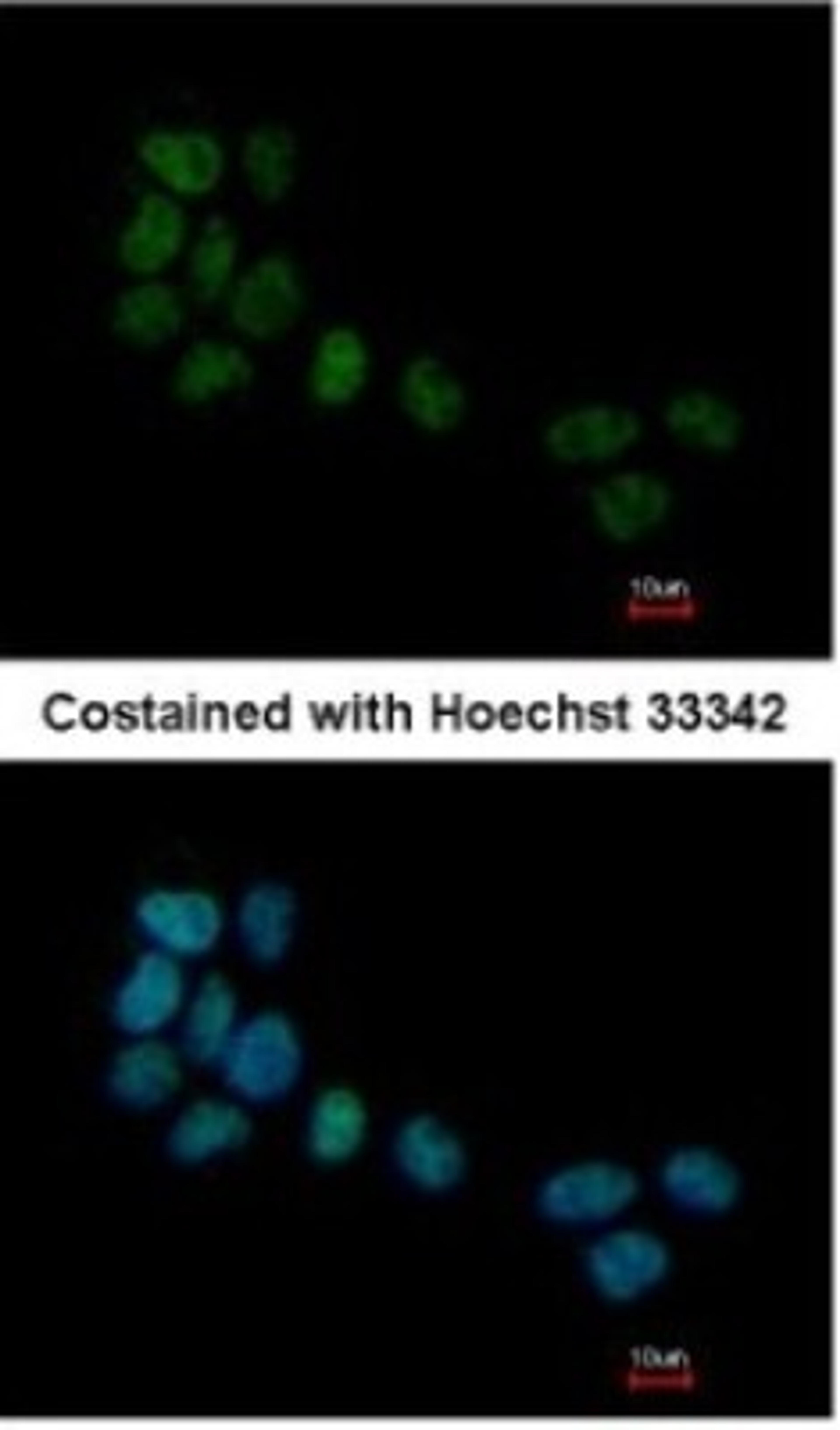 Immunocytochemistry/Immunofluorescence: Serum Response Factor SRF Antibody [NBP1-33063] - Paraformaldehyde-fixed A431, using antibody at 1:500 dilution.