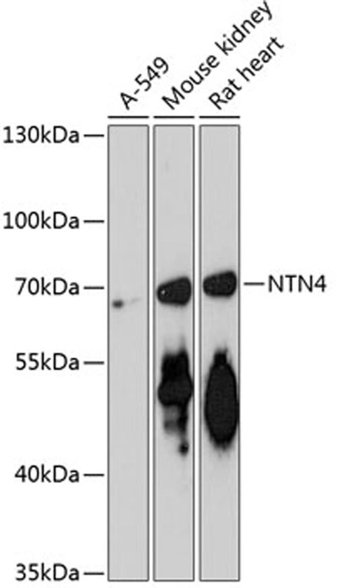 Western blot - NTN4 antibody (A13775)