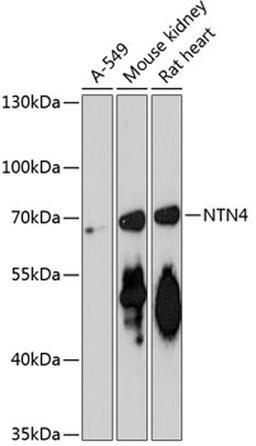 Western blot - NTN4 antibody (A13775)