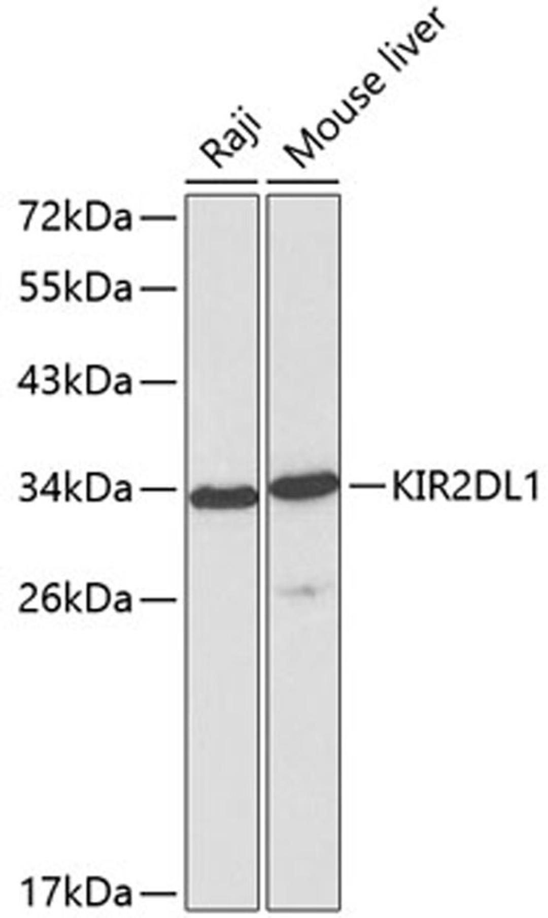 Western blot - KIR2DL1 antibody (A1697)