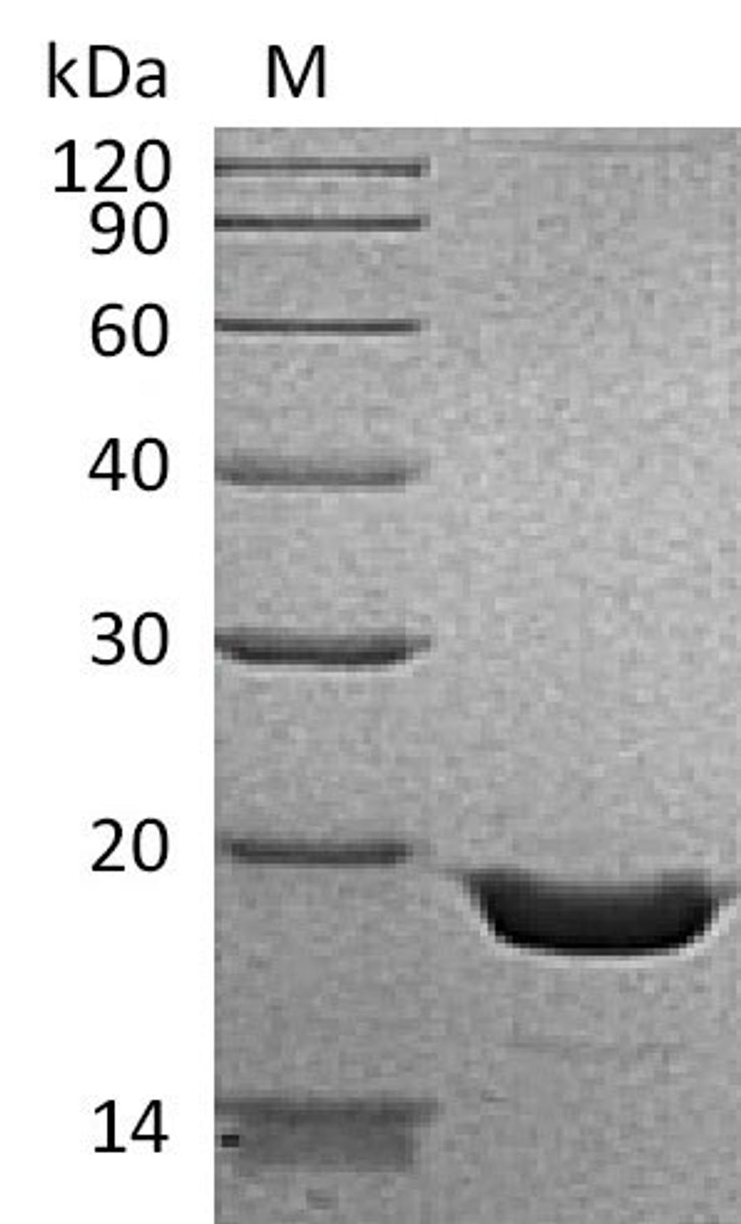 (Tris-Glycine gel) Discontinuous SDS-PAGE (reduced) with 5% enrichment gel and 15% separation gel.