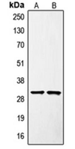 Western blot analysis of Jurkat (Lane 1), mouse liver (Lane 2) whole cell lysates using SURF1 antibody