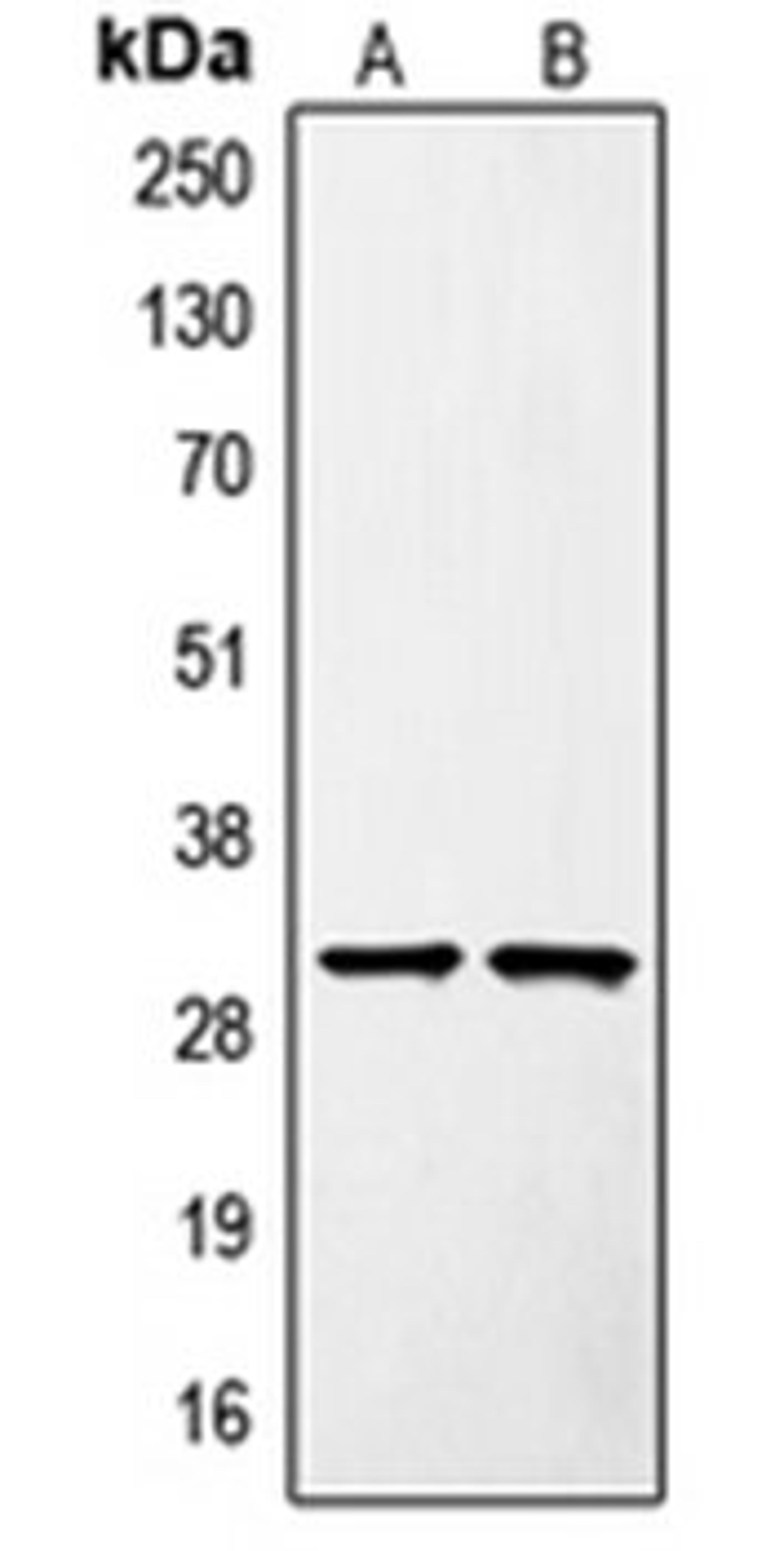 Western blot analysis of Jurkat (Lane 1), mouse liver (Lane 2) whole cell lysates using SURF1 antibody