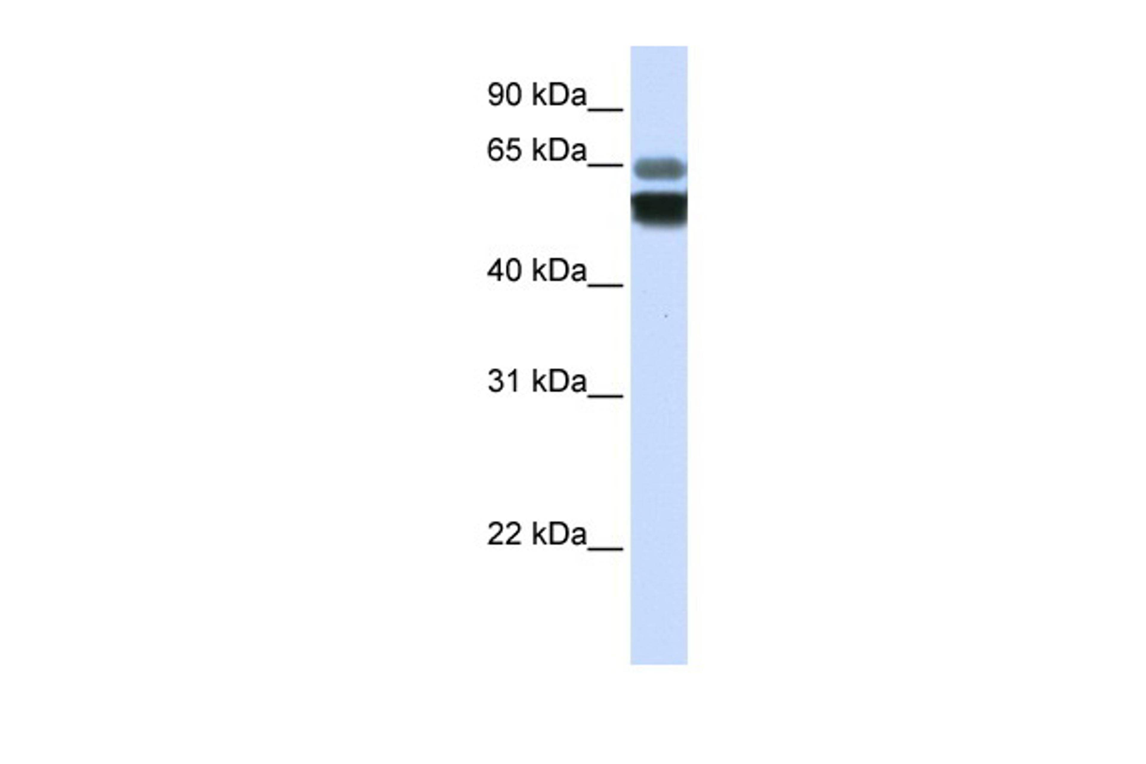 Antibody used in WB on Human Heart at 0.2-1 ug/ml.