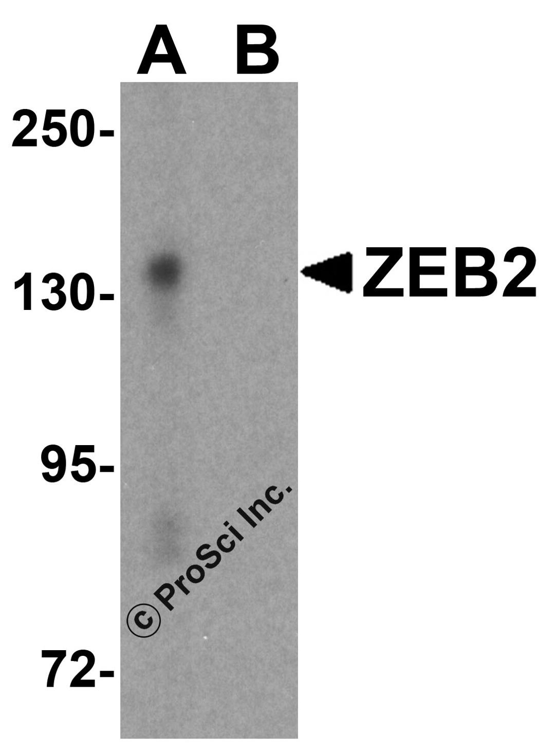 Western blot analysis of ZEB2 in EL4 cell lysate with ZEB2 antibody at 1 μg/mL in (A) the absence and (B) the presence of blocking peptide.