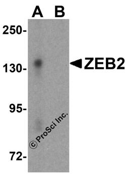 Western blot analysis of ZEB2 in EL4 cell lysate with ZEB2 antibody at 1 μg/mL in (A) the absence and (B) the presence of blocking peptide.