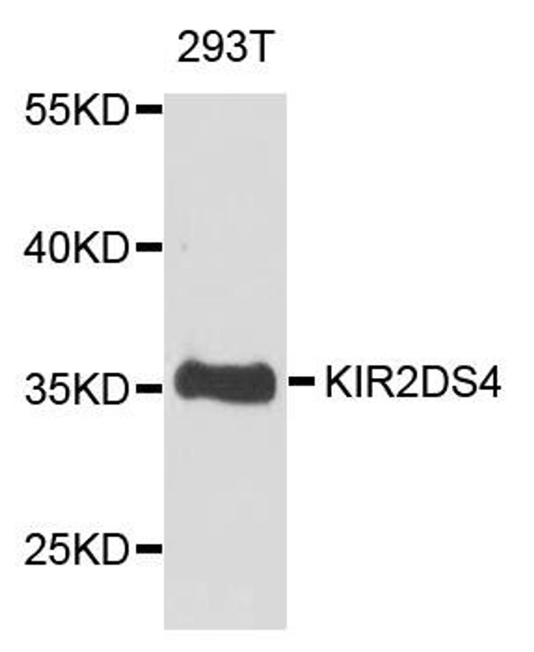 Western blot analysis of extract of various cells using KIR2DS4 antibody