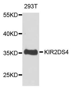 Western blot analysis of extract of various cells using KIR2DS4 antibody