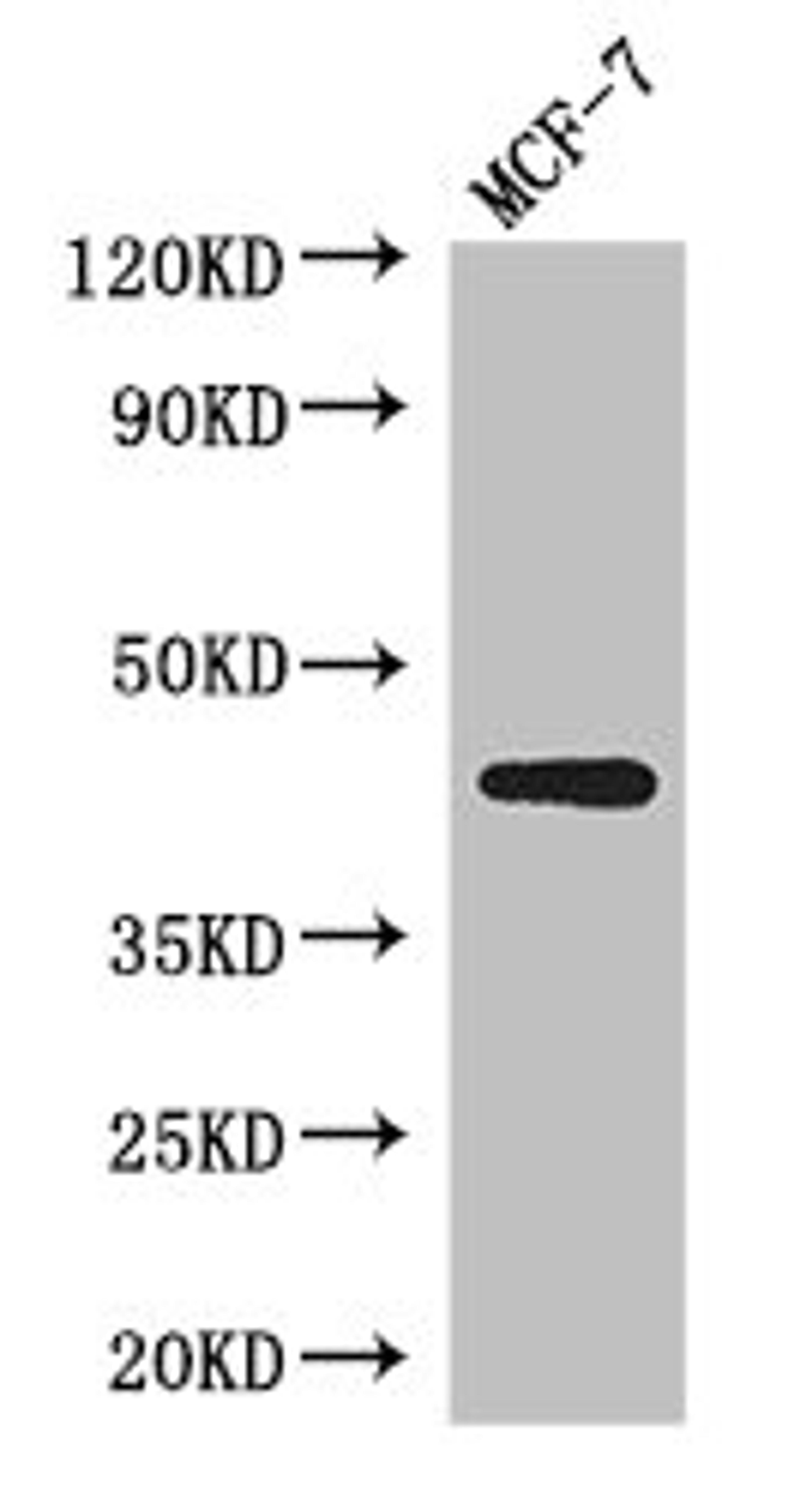 Western Blot. Positive WB detected in: MCF-7 whole cell lysate. All lanes: ADIPOR1 antibody at 2.5µg/ml. Secondary. Goat polyclonal to rabbit IgG at 1/50000 dilution. Predicted band size: 43 kDa. Observed band size: 43 kDa