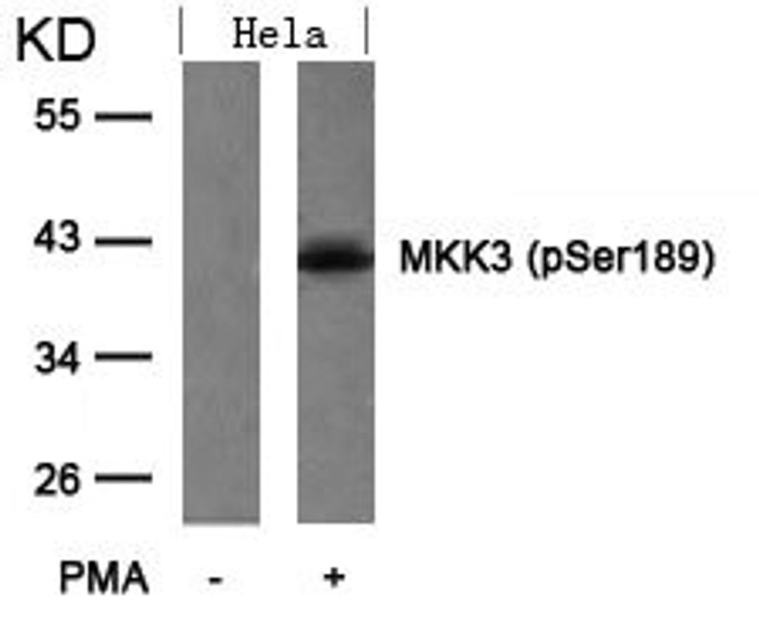 Western blot analysis of extracts from Hela cells untreated or treated with PMA using MKK3(Phospho-Ser189) Antibody.