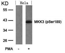 Western blot analysis of extracts from Hela cells untreated or treated with PMA using MKK3(Phospho-Ser189) Antibody.
