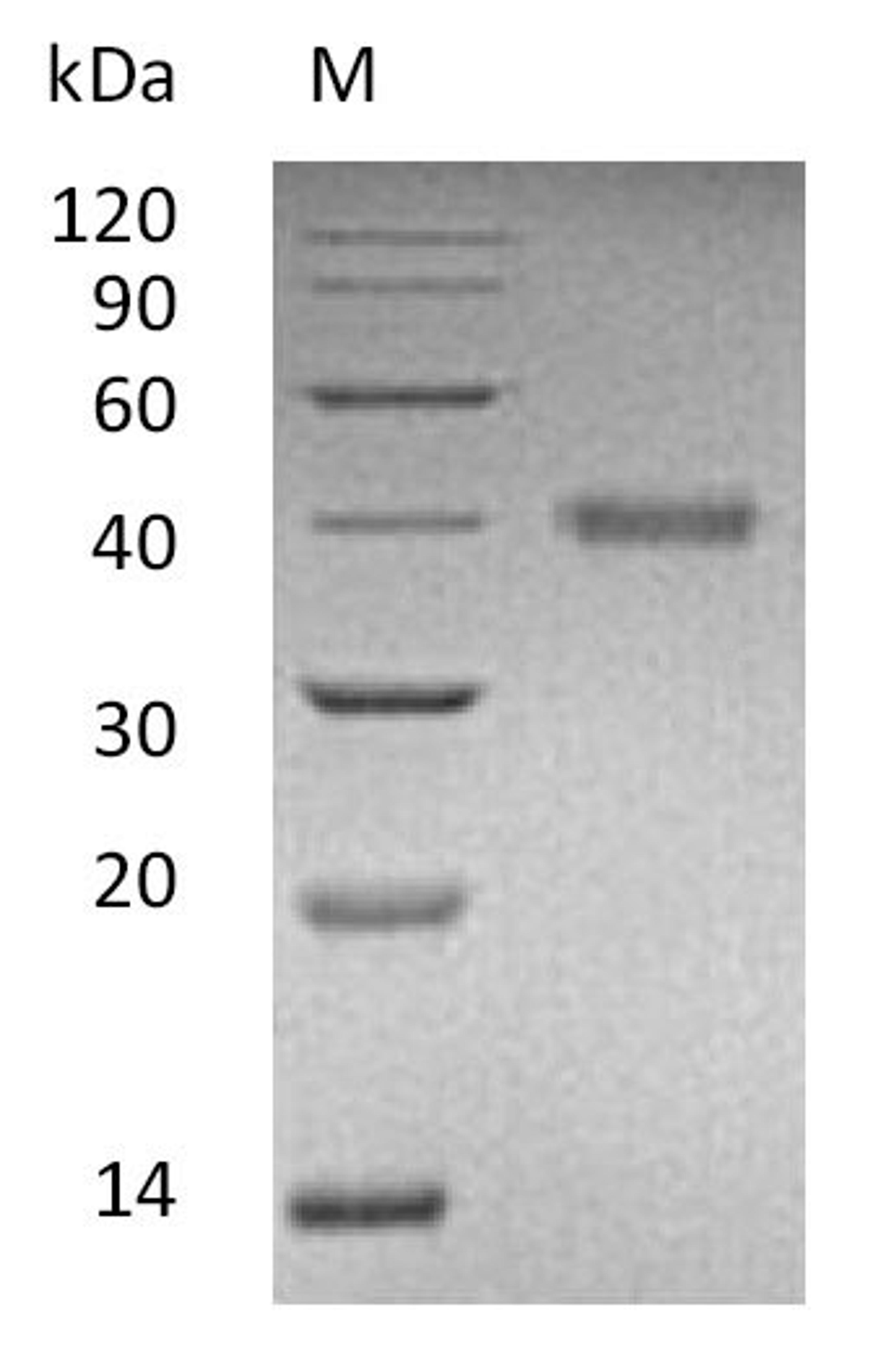 (Tris-Glycine gel) Discontinuous SDS-PAGE (reduced) with 5% enrichment gel and 15% separation gel.