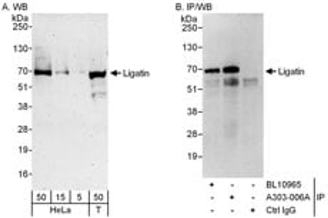 Detection of human Ligatin by western blot and immunoprecipitation.