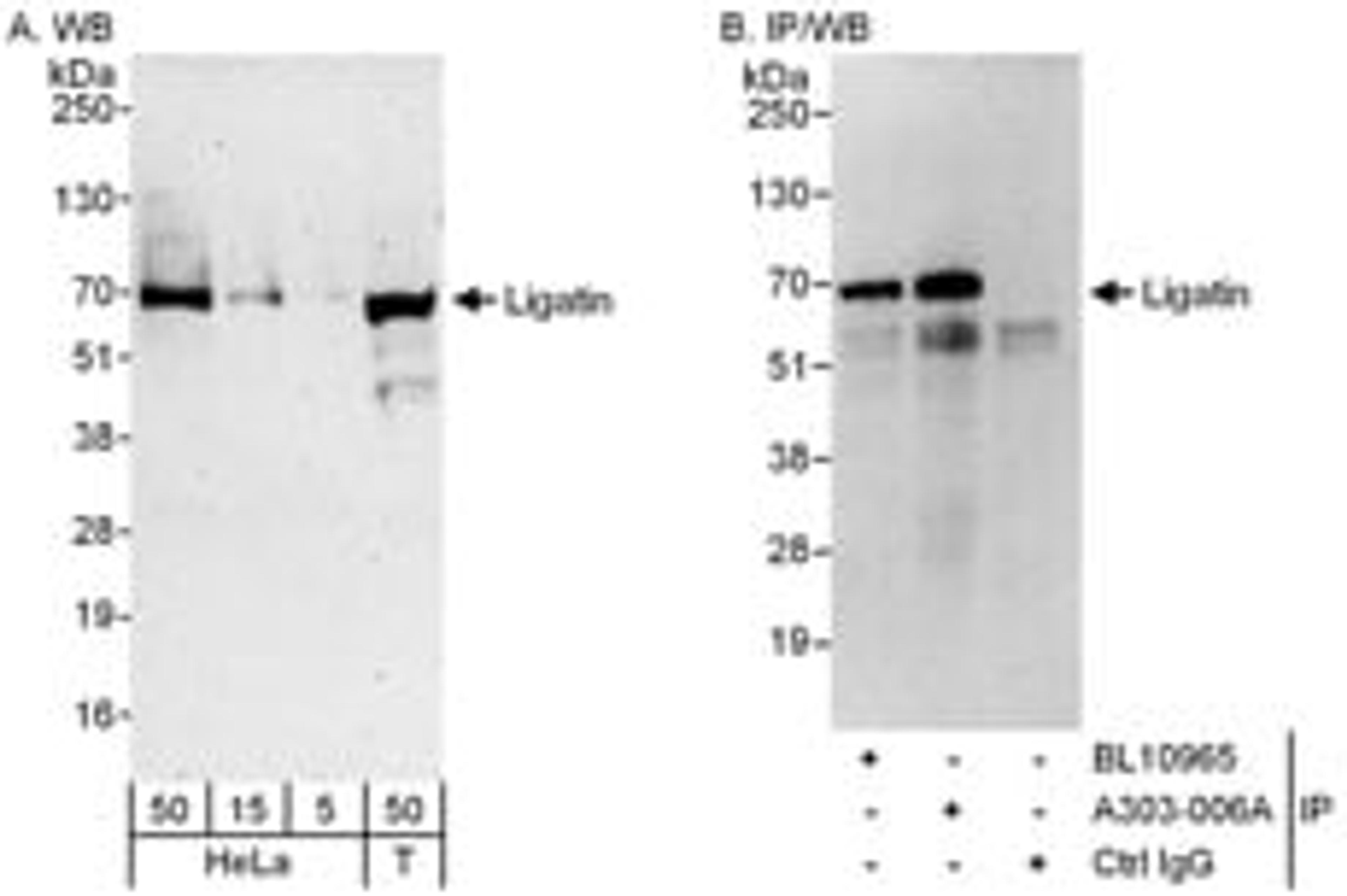 Detection of human Ligatin by western blot and immunoprecipitation.