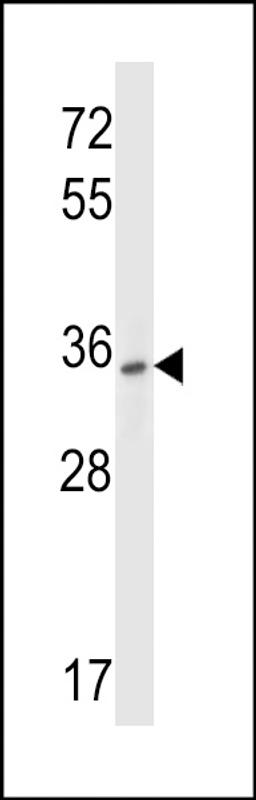 Western blot analysis in HepG2 cell line lysates (35ug/lane).