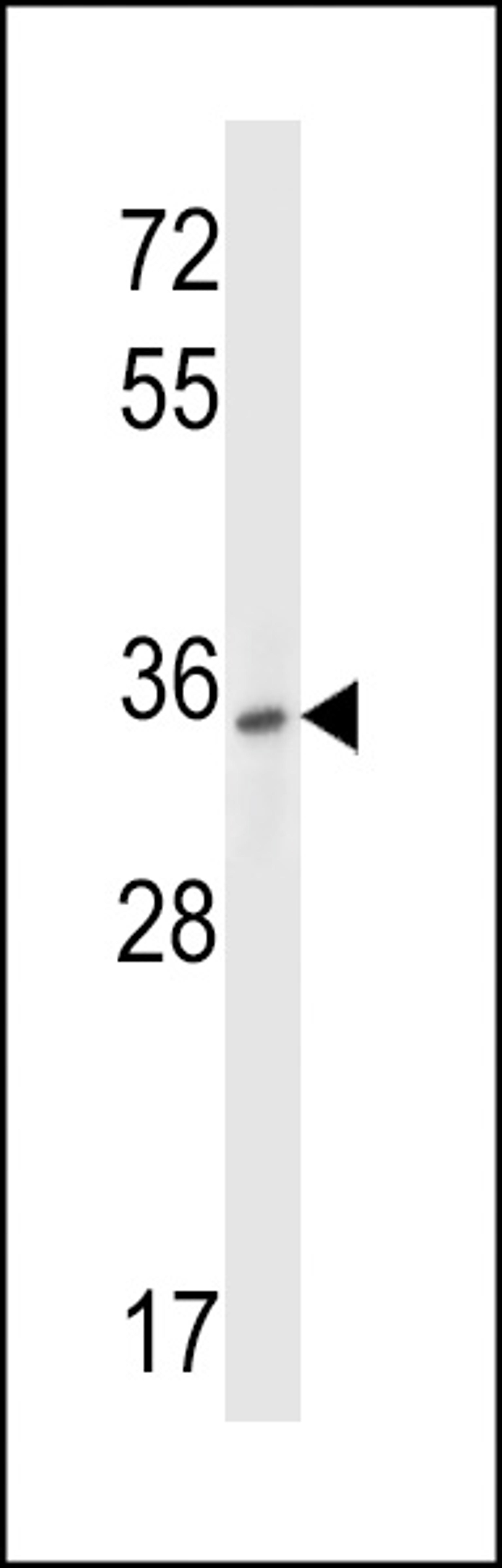 Western blot analysis in HepG2 cell line lysates (35ug/lane).