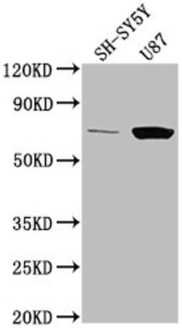 Western Blot. Positive WB detected in: SH-SY5Y whole cell lysate, U87 whole cell lysate. All lanes: TP73 antibody at 1:2000. Secondary. Goat polyclonal to rabbit IgG at 1/50000 dilution. Predicted band size: 70, 55, 54, 45, 62, 60, 65, 50, 48, 63, 39 kDa. Observed band size: 70 kDa. 