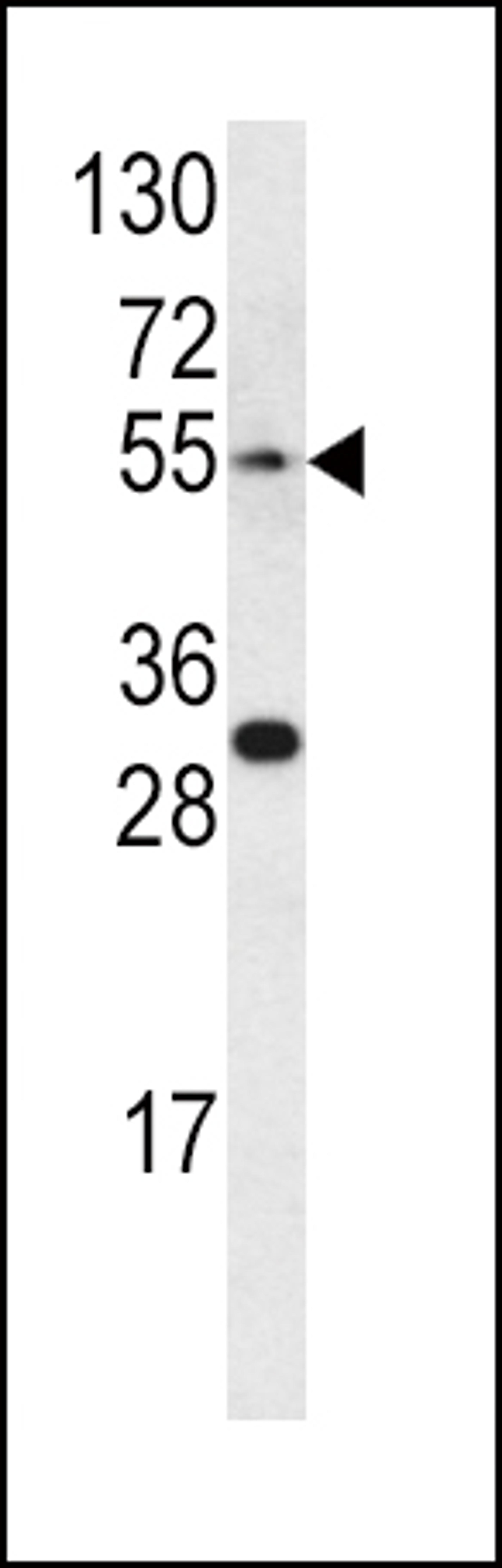 Western blot analysis of EDNRA antibody in CEM cell line lysates (35ug/lane)