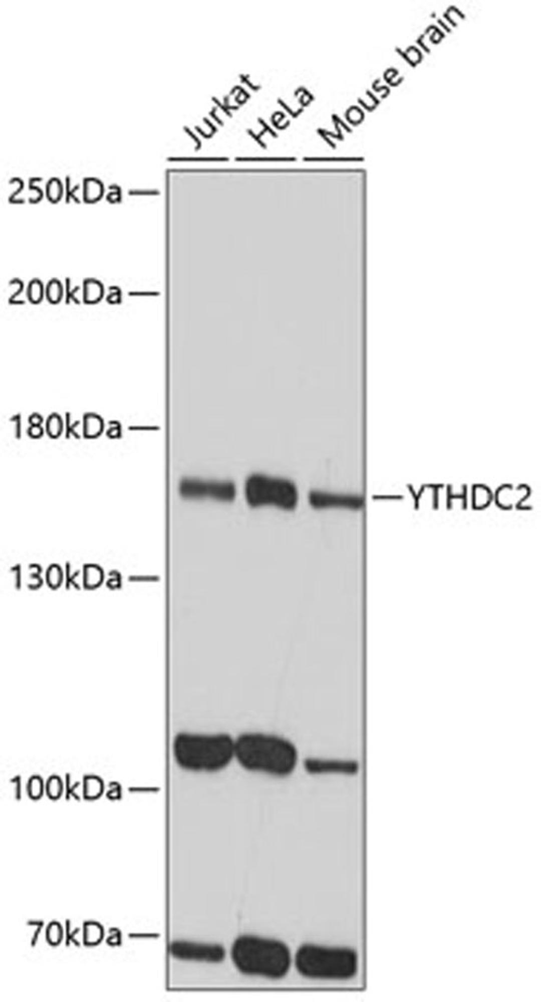 Western blot - YTHDC2 antibody (A15004)