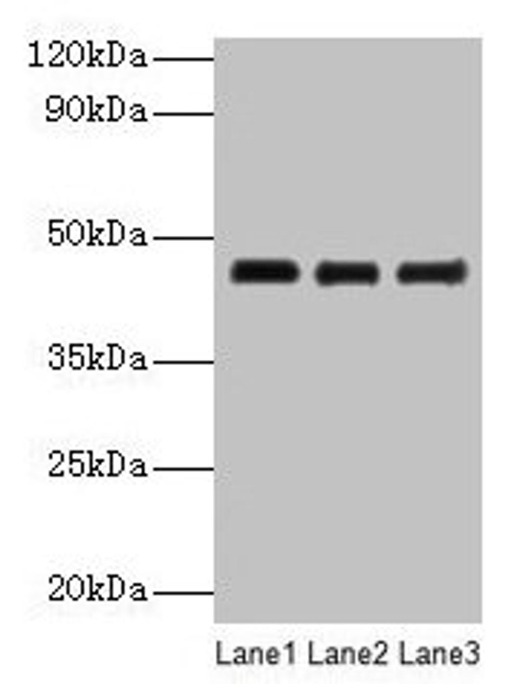 Western blot. All lanes: SERPINB14 antibody at 2µg/ml. Lane 1: Ovalbumin at 1: 4000. Lane 2: Ovalbumin at 1: 8000. Lane 3: Ovalbumin at 1: 16000. Secondary. Goat polyclonal to rabbit IgG at 1/10000 dilution. Predicted band size: 46 kDa. Observed band size: 46 kDa