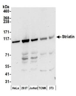 Detection of human and mouse Striatin by western blot.