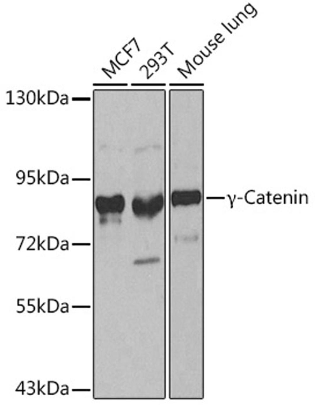 Western blot - ?-Catenin antibody (A0963)