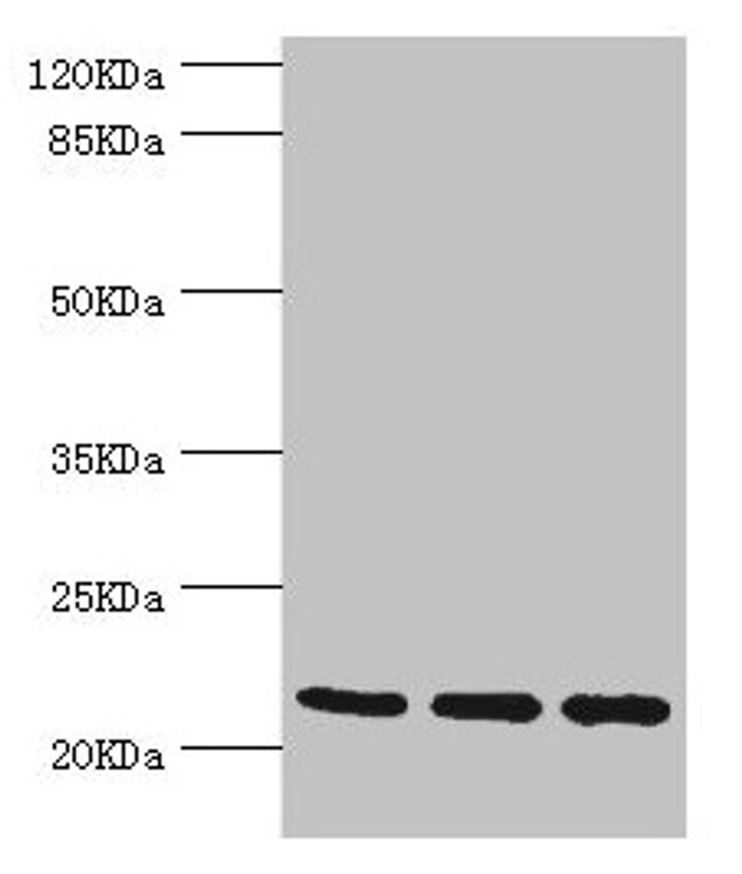 Western blot. All lanes: TAGLN2 antibody at 2.64µg/ml. Lane 1: 293T whole cell lysate. Lane 2: K562 whole cell lysate. Lane 3: MCF-7 whole cell lysate. Secondary. Goat polyclonal to rabbit IgG at 1/10000 dilution. Predicted band size: 23, 25 kDa. Observed band size: 23 kDa