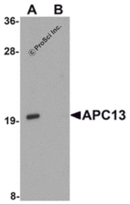 Western blot analysis of APC13 in Jurkat cell tissue lysate with APC13 antibody at 1 μg/mL in (A) the absence and (B) the presence of blocking peptide.