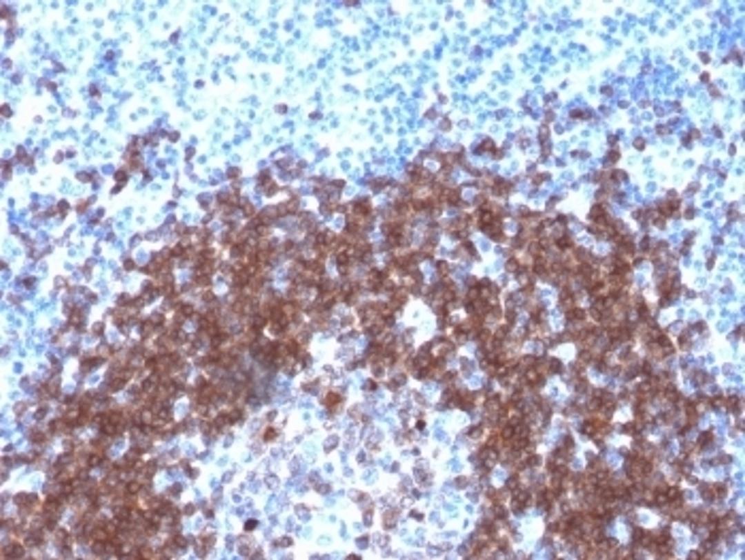 IHC testing of FFPE human tonsil with recombinant CD79a antibody (clone IGA/1790R). Required HIER: boil tissue sections in 10mM citrate buffer, pH 6, for 10-20 min followed by cooling at RT for 20 min.