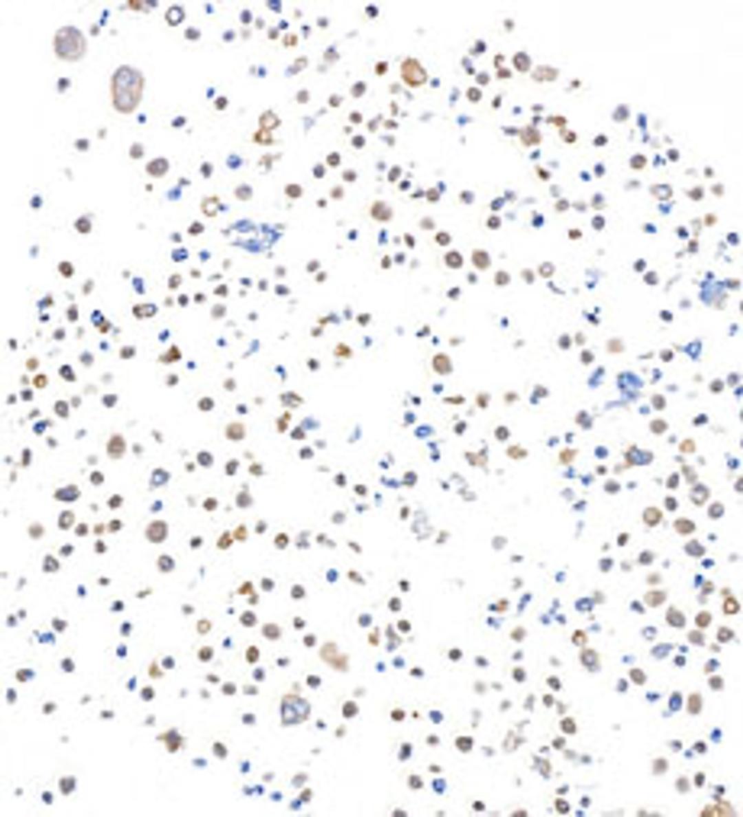 Detection of human SMAD4 in FFPE RPMI-8226 cells by immunocytochemistry.