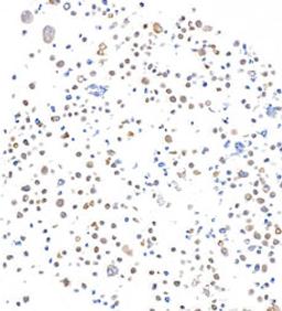 Detection of human SMAD4 in FFPE RPMI-8226 cells by immunocytochemistry.