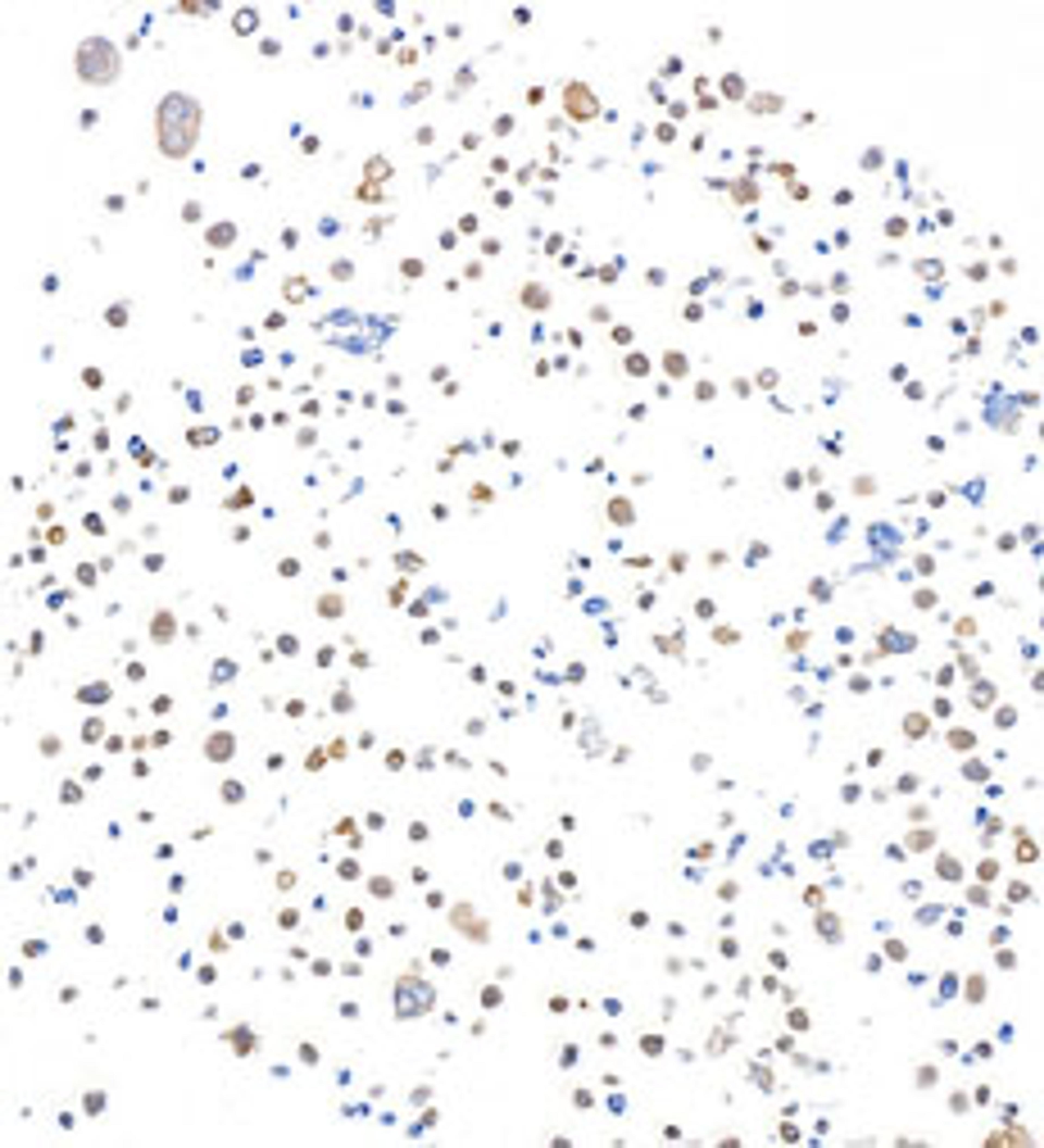 Detection of human SMAD4 in FFPE RPMI-8226 cells by immunocytochemistry.