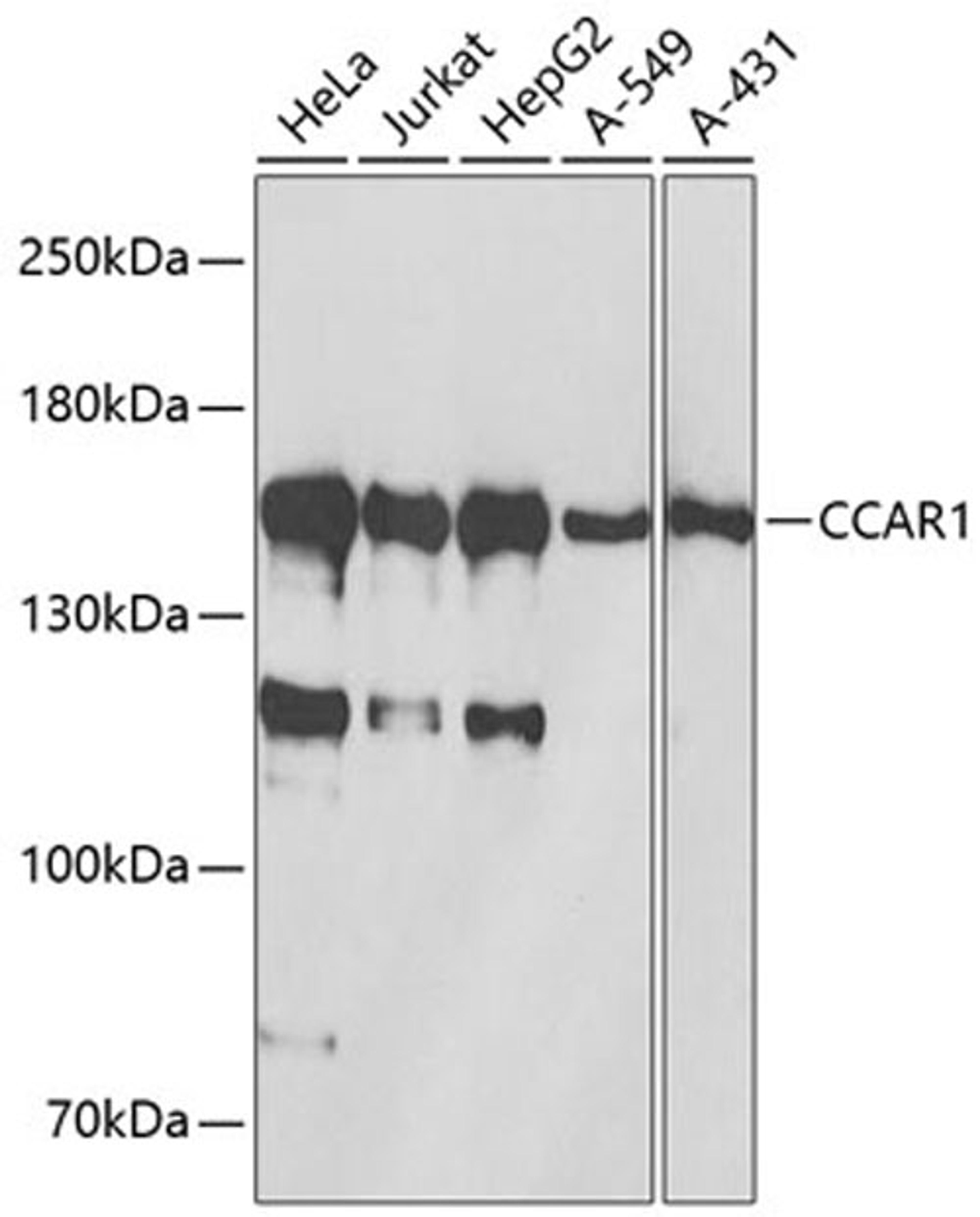 Western blot - CCAR1 antibody (A13595)