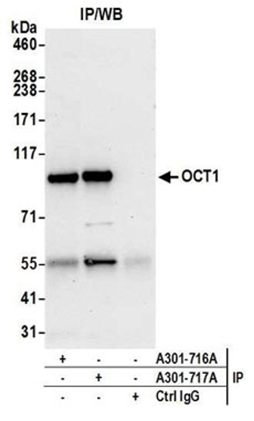 Detection of human OCT1 by western blot of immunoprecipitates.