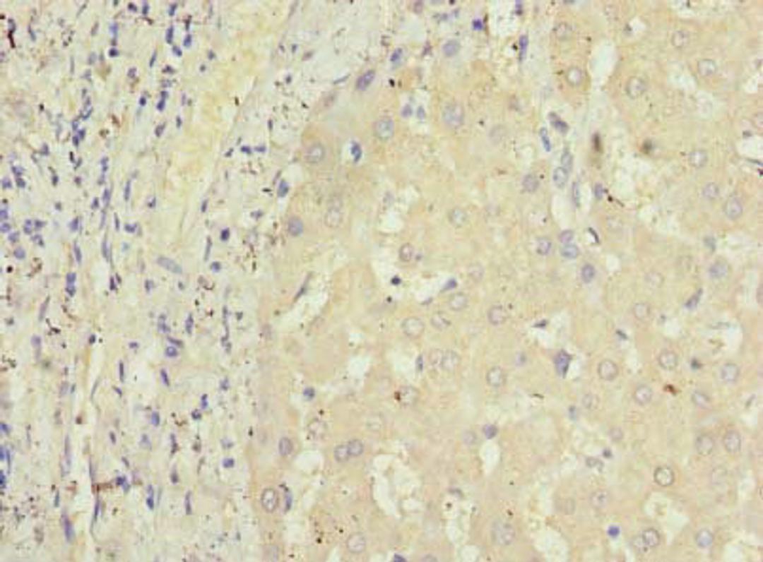 Immunohistochemistry of paraffin-embedded human liver tissue using CSB-PA850271LA01HU at dilution of 1:100