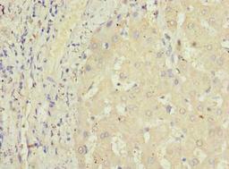 Immunohistochemistry of paraffin-embedded human liver tissue using CSB-PA850271LA01HU at dilution of 1:100
