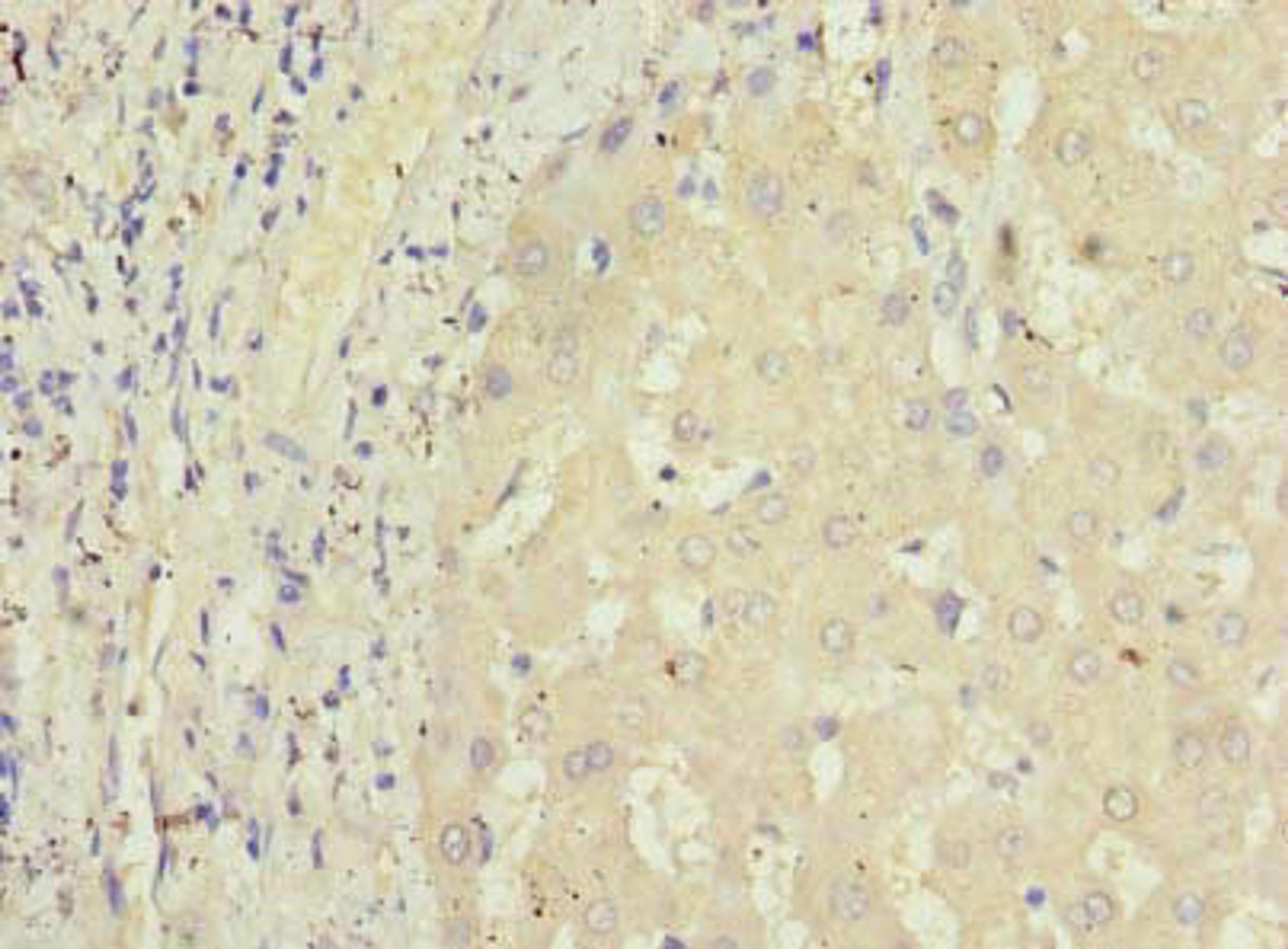 Immunohistochemistry of paraffin-embedded human liver tissue using CSB-PA850271LA01HU at dilution of 1:100