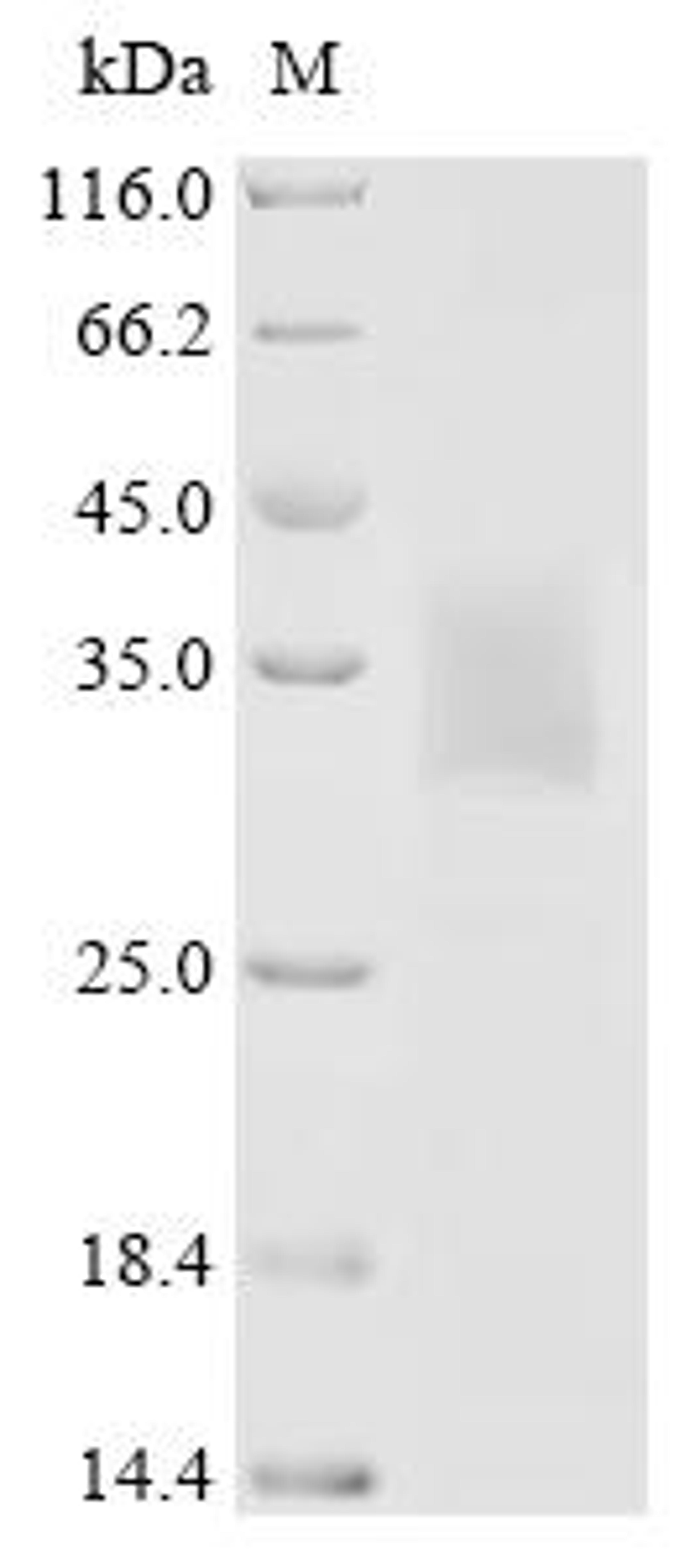 (Tris-Glycine gel) Discontinuous SDS-PAGE (reduced) with 5% enrichment gel and 15% separation gel.