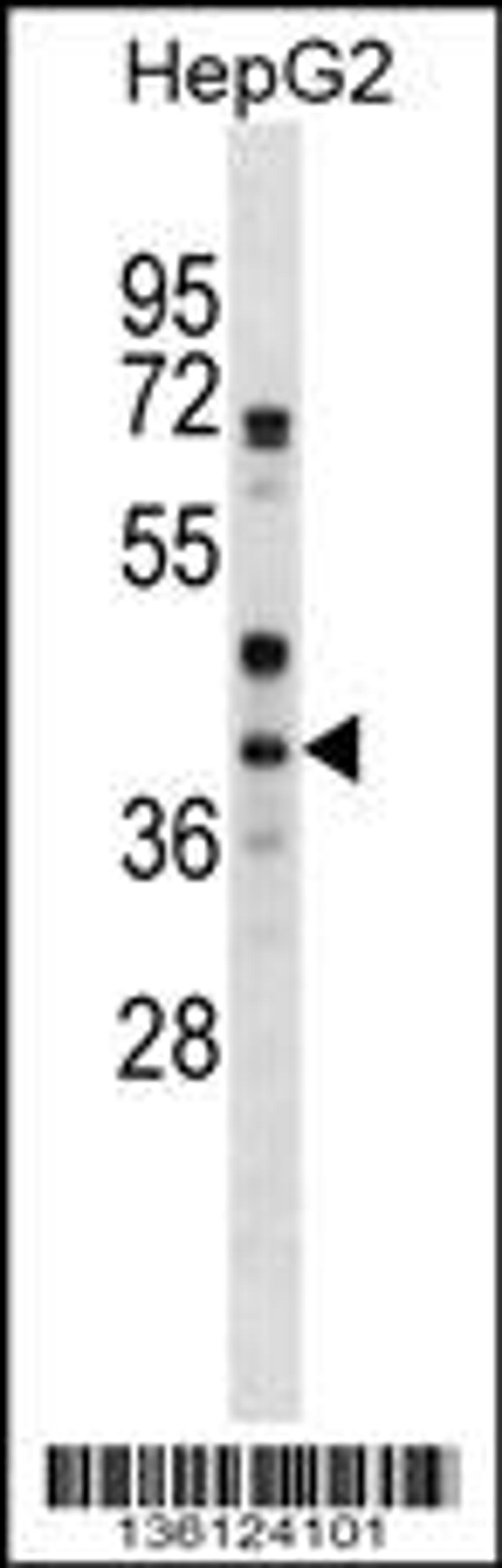 Western blot analysis in HepG2 cell line lysates (35ug/lane).