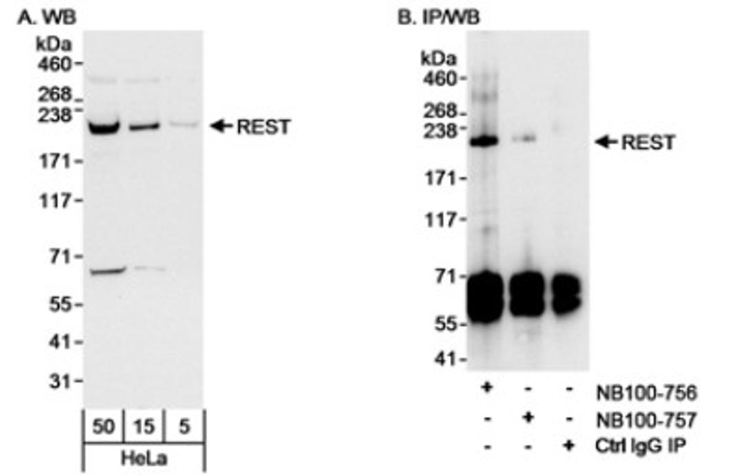 Western Blot: NRSF Antibody [NB100-757] - Detection of Human REST on HeLa whole cell lysate using NB100-757. REST was most efficiently immunoprecipitated using rabbit anti-REST antibody NB100-756 at 3 ug/mg lysate.