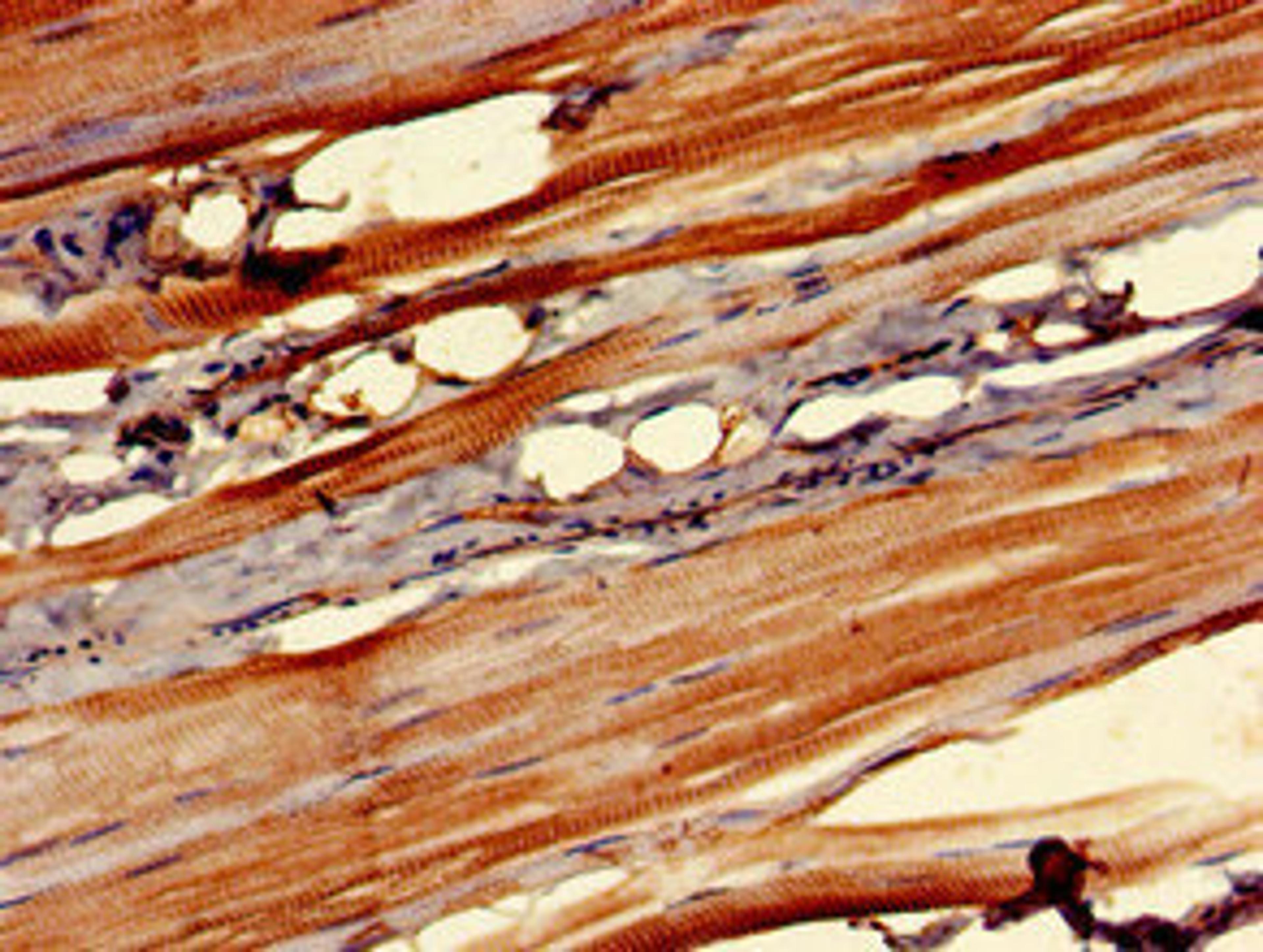 Immunohistochemistry of paraffin-embedded human skeletal muscle tissue using CSB-PA857869LA01HU at dilution of 1:100
