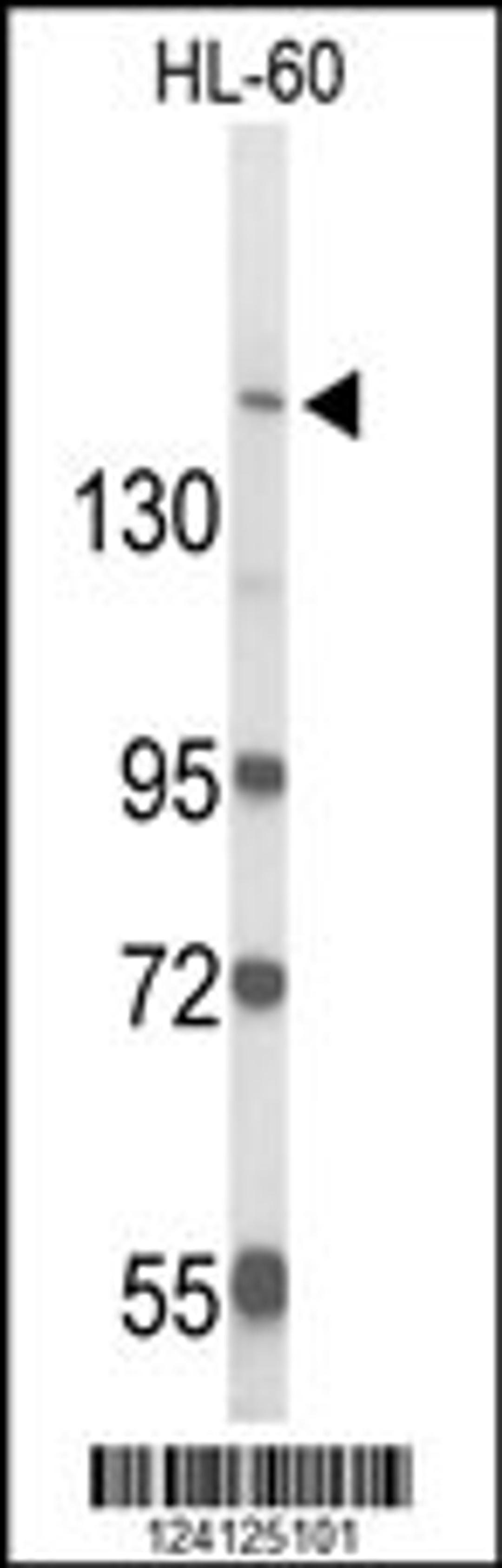 Western blot analysis of RAB3GAP2 Antibody in HL-60 cell line lysates (35ug/lane)