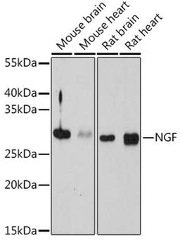 Western blot - NGF antibody (A14216)