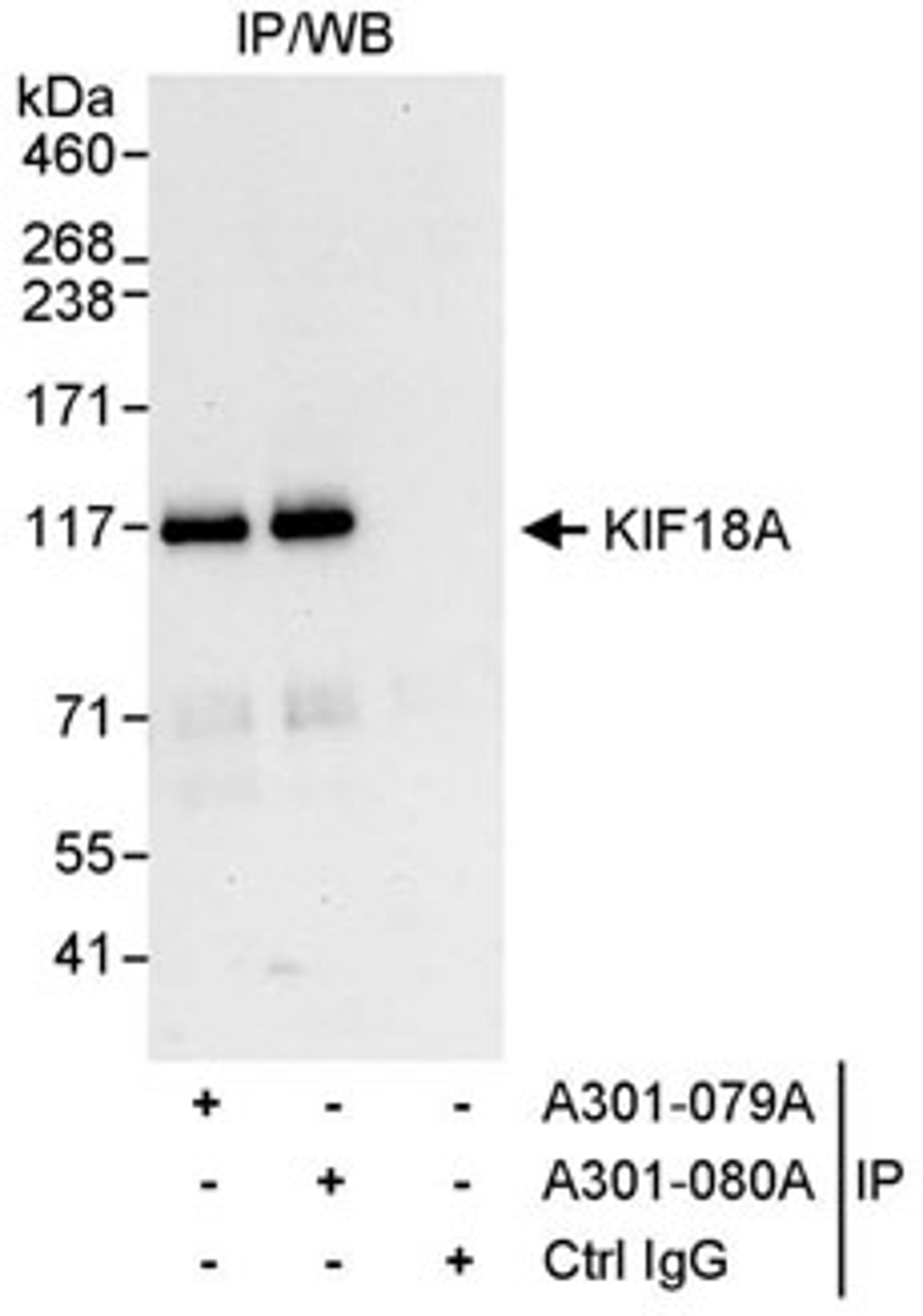 Detection of human KIF18A by western blot of immunoprecipitates.